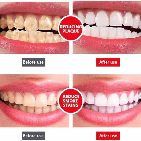 SP7 Ultra-Advanced Whitening Toothpaste — Strongest Formula Ever Made