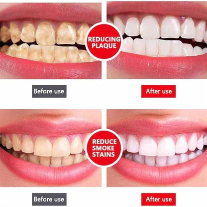SP7 Ultra-Advanced Whitening Toothpaste — Strongest Formula Ever Made